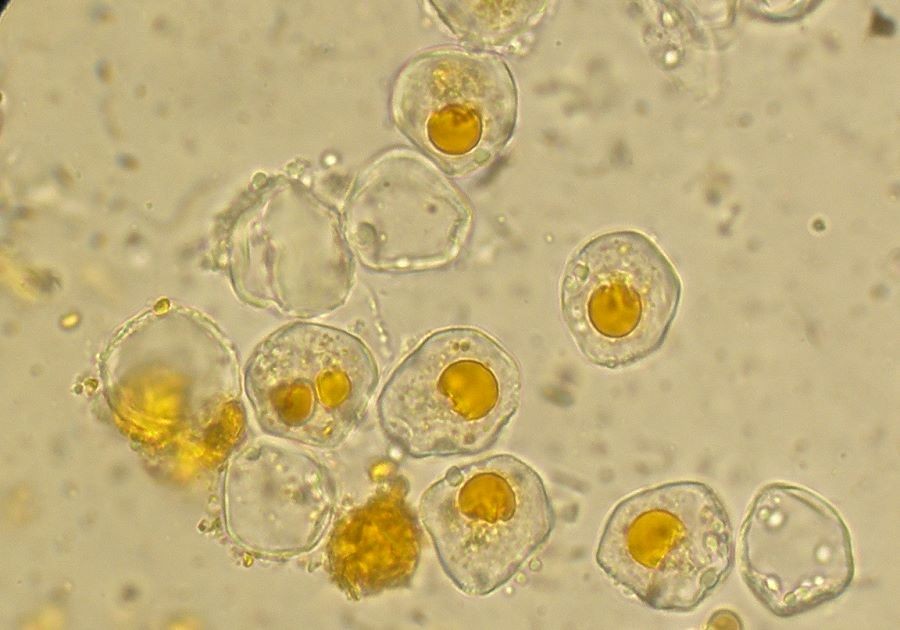 Aecidium_teodorescui003 Die I-Aeziosporen sind rundlich bis polyedrisch 15 -18 (26 ) lang und ( 14 )17 - 23 µm breit, die Wand ist farblos 1,5 - 2 µm dick, feinwarzig, Inhalt gelb.