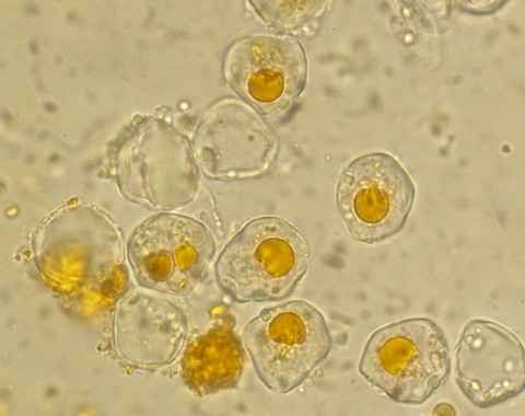 Aecidium_teodorescui003 Die I-Aeziosporen sind rundlich bis polyedrisch 15 -18 (26 ) lang und ( 14 )17 - 23 µm breit, die Wand ist farblos 1,5 - 2 µm dick, feinwarzig, Inhalt gelb.