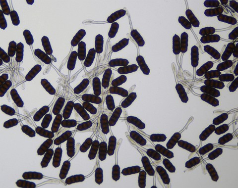 Phragmidium_violaceum004 Phragmidium violaceum ( Schultz ) G. Winter Die Teliosporen sind walzenförmig und meist vierzellig. Drei.- oder gar fünfzellige Sporen konnte ich auch...