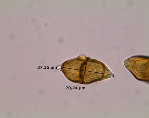Puccinia_asarina002 III-Teleutosporen meist kurz spindelförmig, of asymetrisch, 28 - 44 µm lang, 14 - 24 µm breit, am Scheitel papillenförmig ausgezogen, am Grund mehr oder weniger...