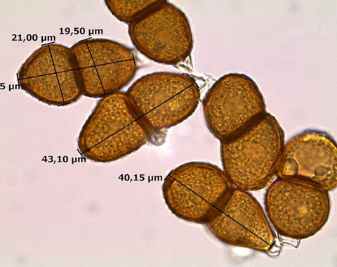 Puccinia_veratri001 III-Teleutosporen meist ellipsoidisch, oben und unten gerundet, an der Grenze beider Zellen stark eingeschnürt; Länge 28 - 45 µm,Ø 16 - 24 µm; beide Zellen...