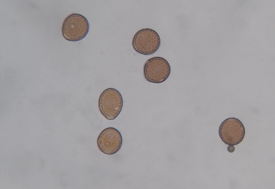 Uromyces_valerianae001 Uromyces valerianae Fuckel 1870 Bemerkungen: II - Uredosporen bei 400 - facher Vergrößerung.