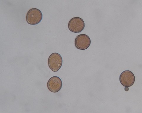 Uromyces_valerianae001 Uromyces valerianae Fuckel 1870 Bemerkungen: II - Uredosporen bei 400 - facher Vergrößerung.