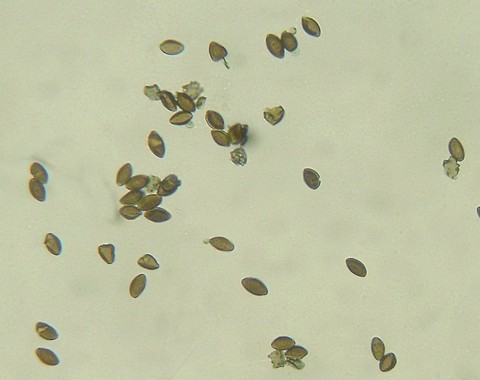 Uromyces_valerianae002 Uromyces valerianae Fuckel 1870 Bemerkungen: III - Teleutosporen bei 400 - facher Vergrößerung