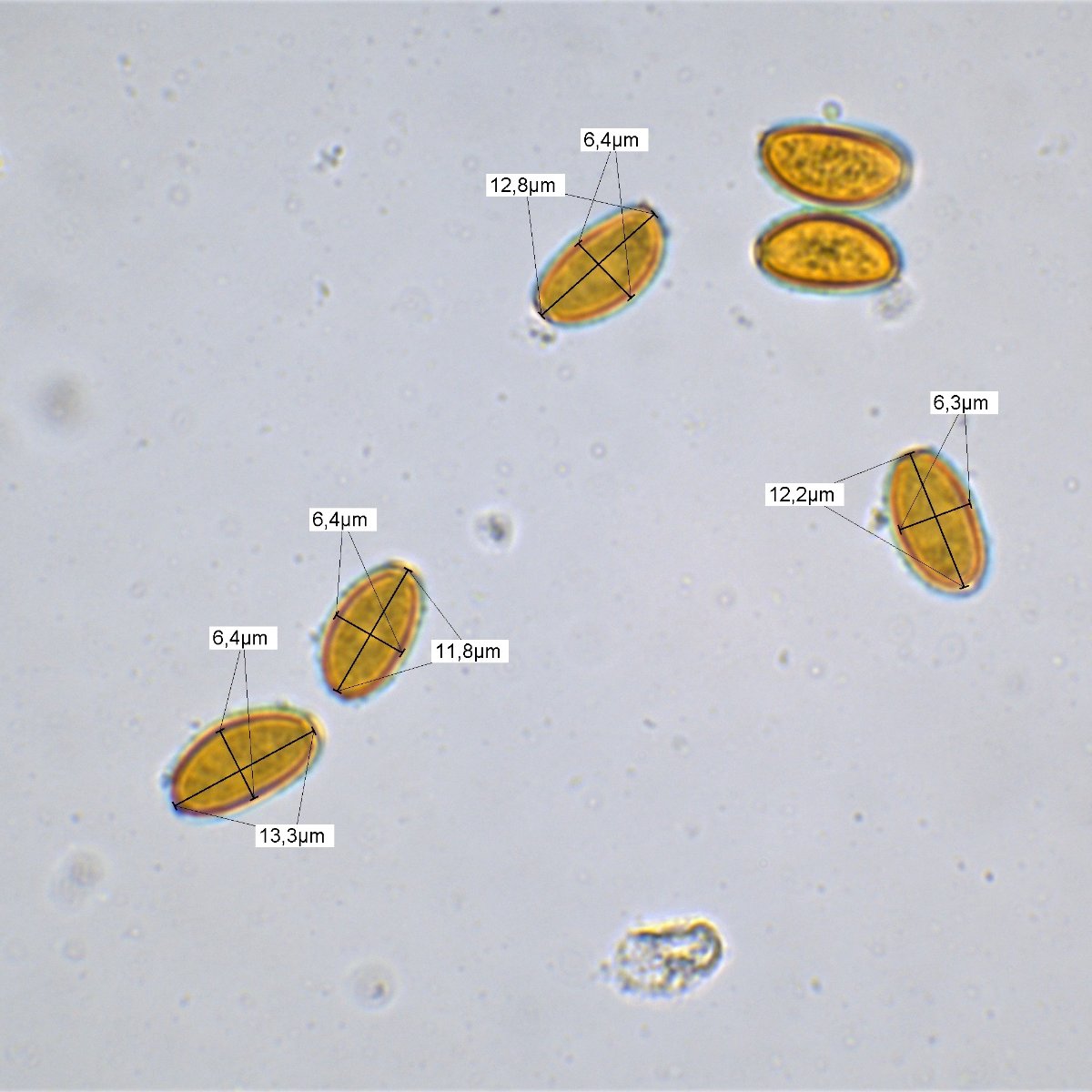 Messung Sporen 100x Öl Wasser 8.jpg