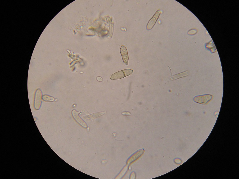 1000er Kronach (5).JPG