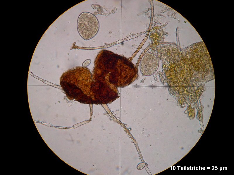 2-Erysiphe necator-2.2.3.1a.2.85M1-Vitis vinifera.JPG