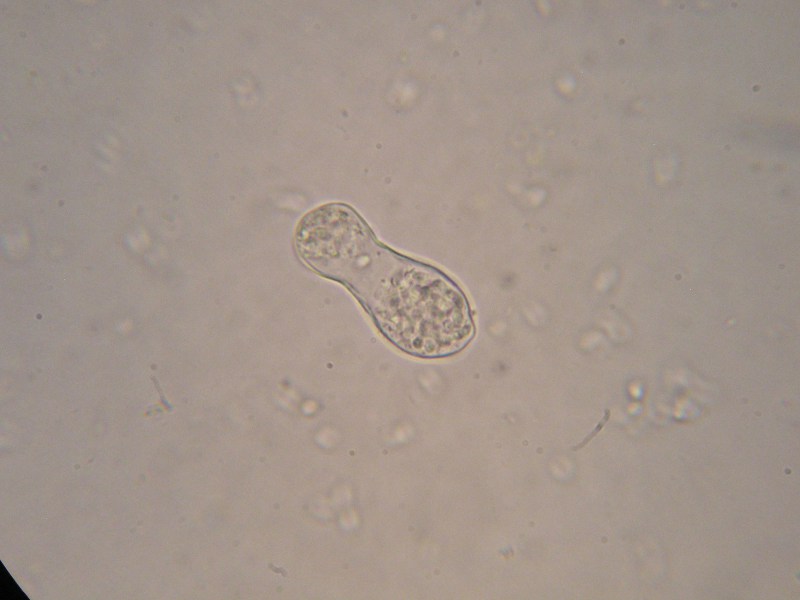 1000er Frankenheim (14).JPG