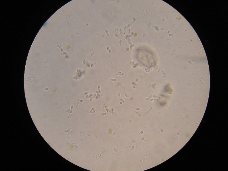 1000er Frankenheim (25).JPG