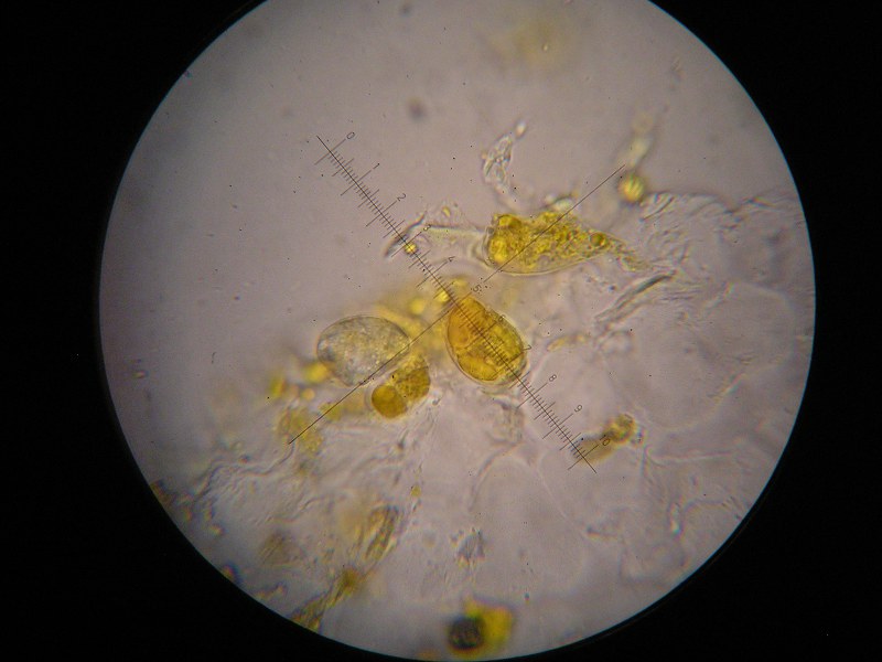 1000er ÖBG (17).JPG