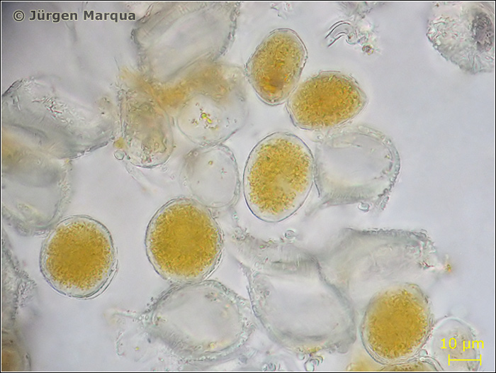 Puccinia-poarum02-spm.jpg