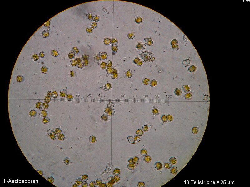 3-Aecidium teodorescui-I-M1-Berberis vulgaris.JPG