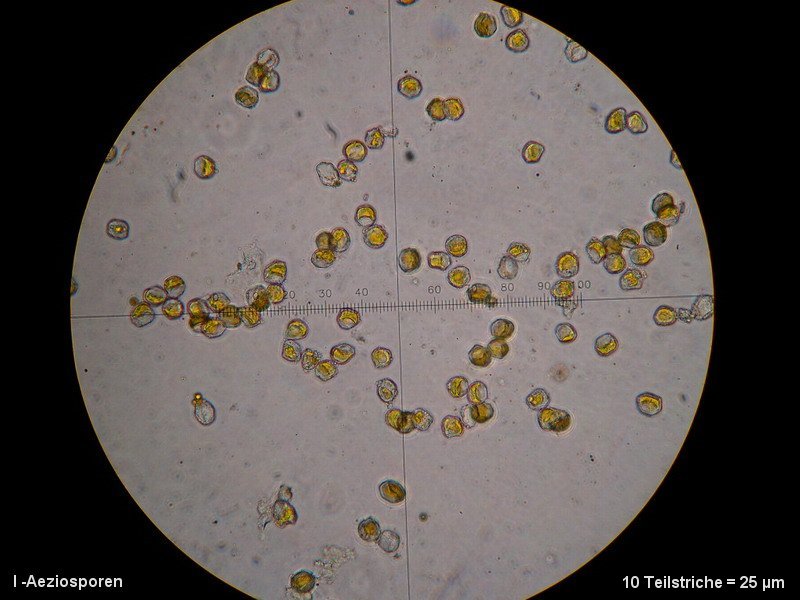 3-Aecidium teodorescui-I-M2-Berberis vulgaris.JPG