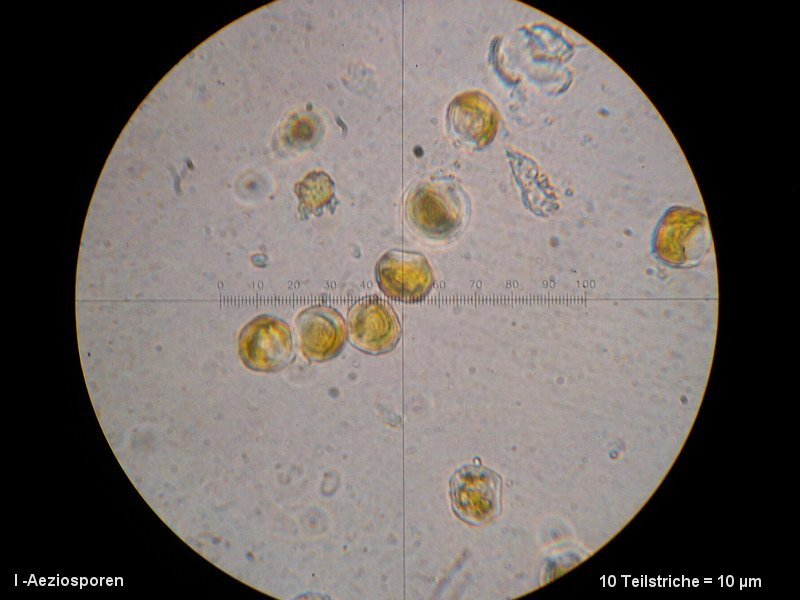 3-Aecidium teodorescui-I-M3-Berberis vulgaris.JPG