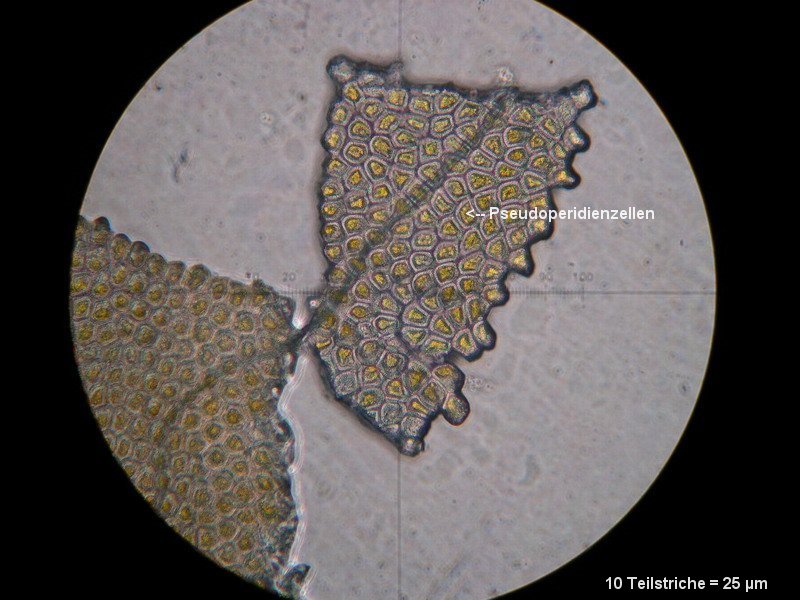 3-Aecidium teodorescui-I-M4-Berberis vulgaris.JPG