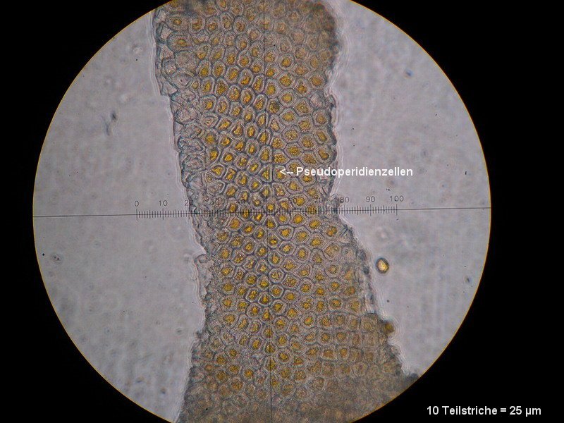 3-Aecidium teodorescui-I-M5-Berberis vulgaris.JPG