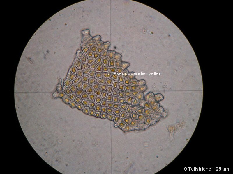 3-Aecidium teodorescui-I-M6-Berberis vulgaris.JPG