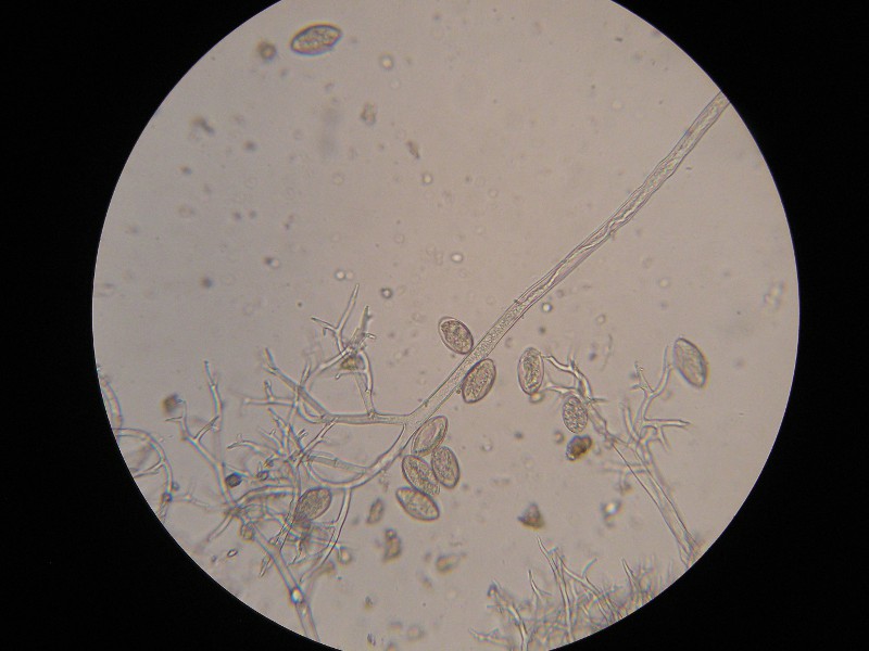 400er Sondheim (5).JPG