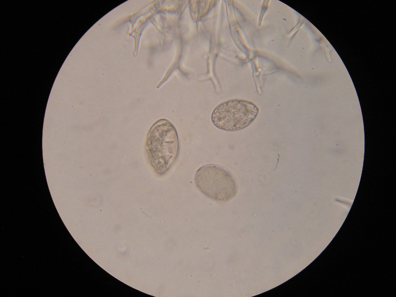 1000er Sondheim (2).JPG