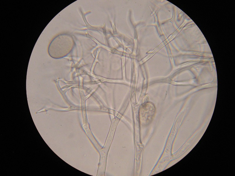 1000er Sondheim (8).JPG