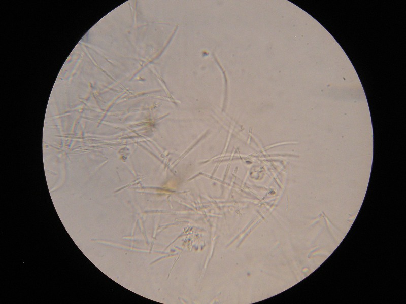 1000er Lilienthal (13).JPG