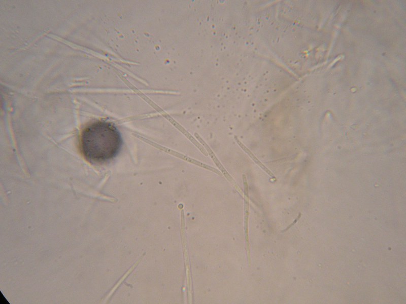 1000er Lilienthal (16).JPG