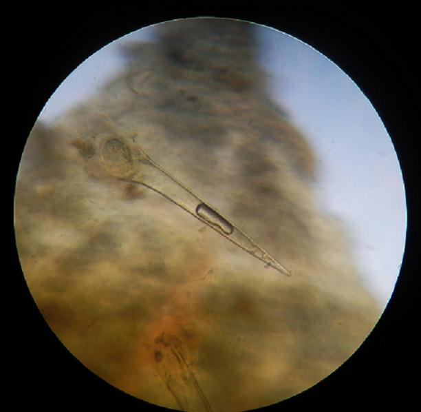 Ph. vulgaris_IIa.jpg