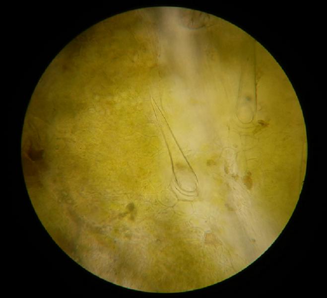 Ph. vulgaris_IIIa.jpg