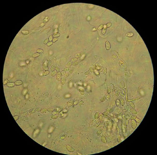 Gyroporus cyanescens_10.jpg