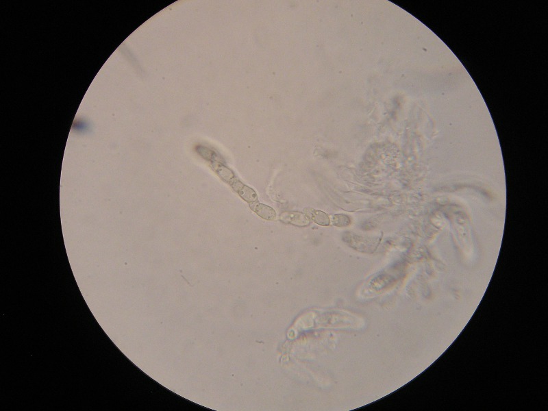 1000er Kaiser (1).JPG