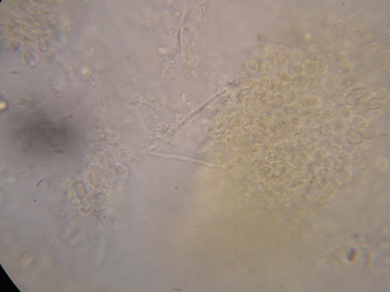 1000er Wiesl (8).JPG