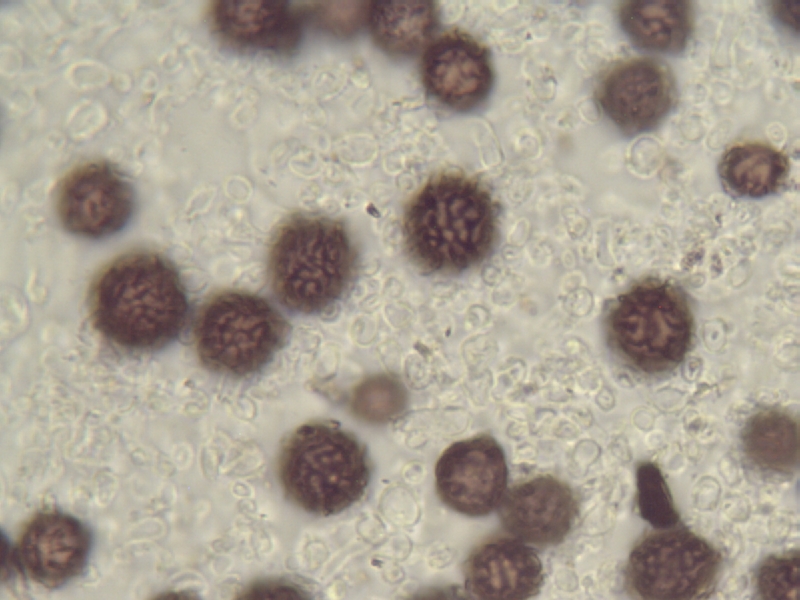 Sporenornament Sclerod. bovista_1.JPG