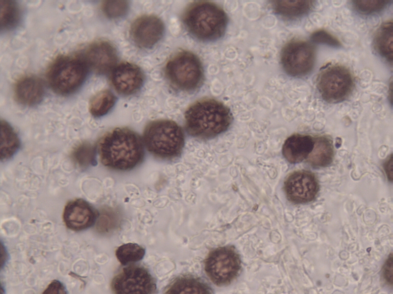 Sporenornament Sclerod. bovista_3.JPG