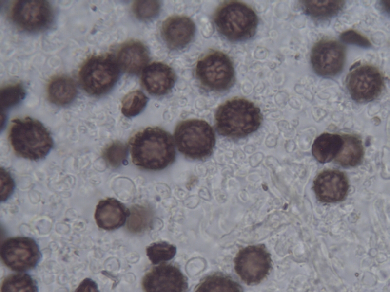 Sporenornament Sclerod. bovista_4.JPG