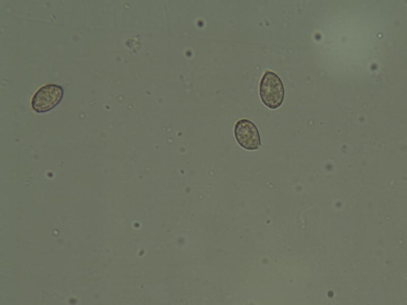 Sporen Cort. flexipes.JPG