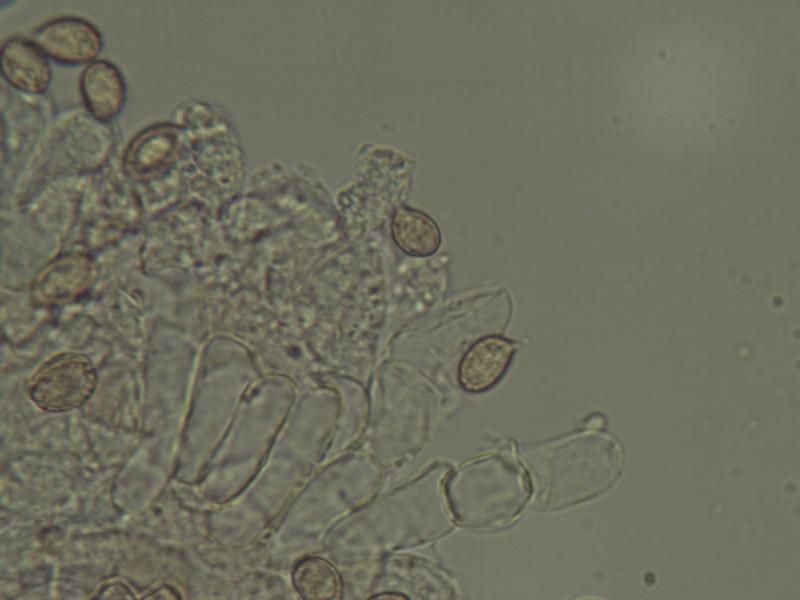 Sporen & Cheilozystiden.JPG