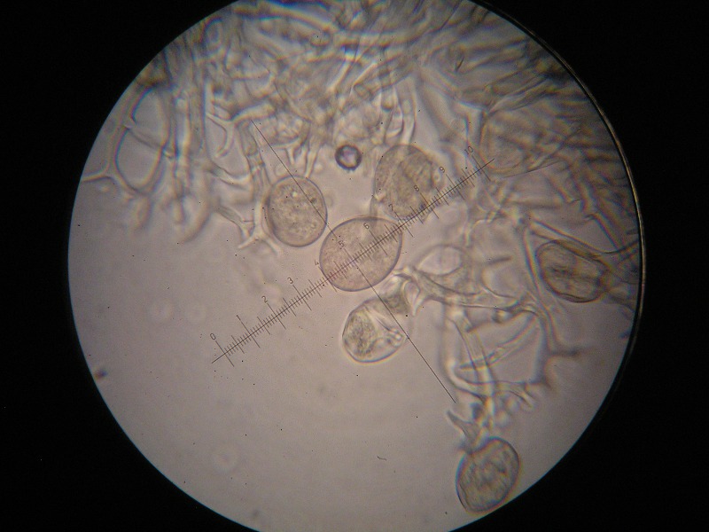 400er Sondheim (6).JPG