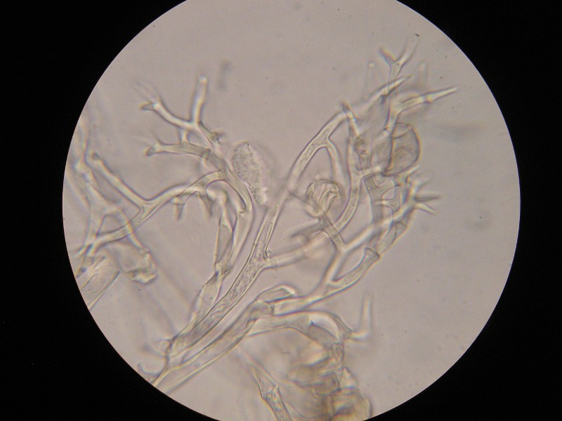 400er Sondheim (10).JPG