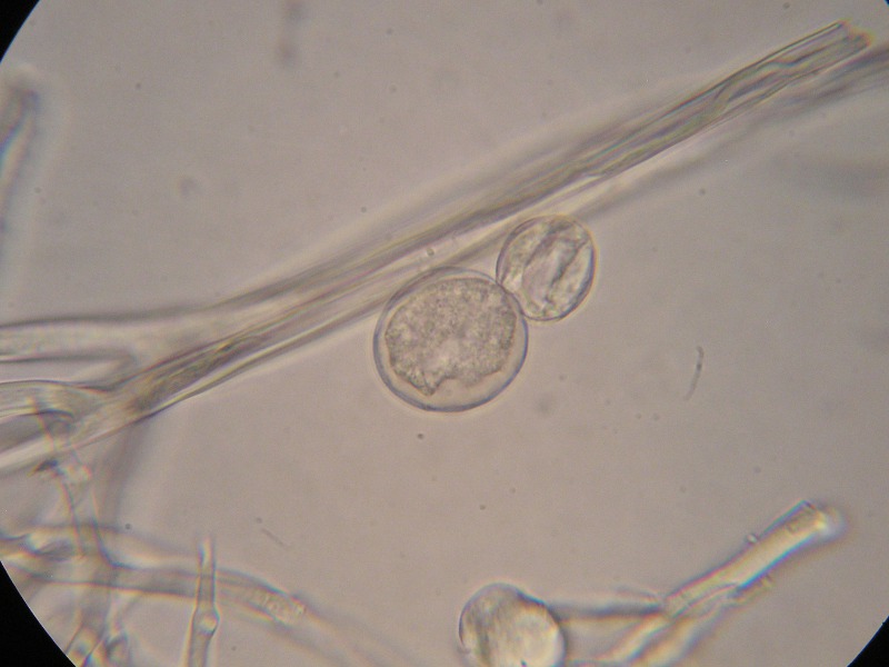 400er Sondheim (12).JPG