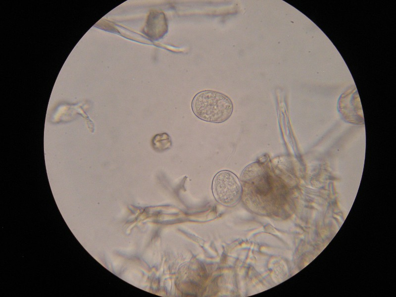 400er Sondheim (17).JPG