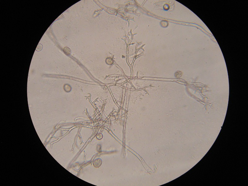 400er  Eckern (1).JPG