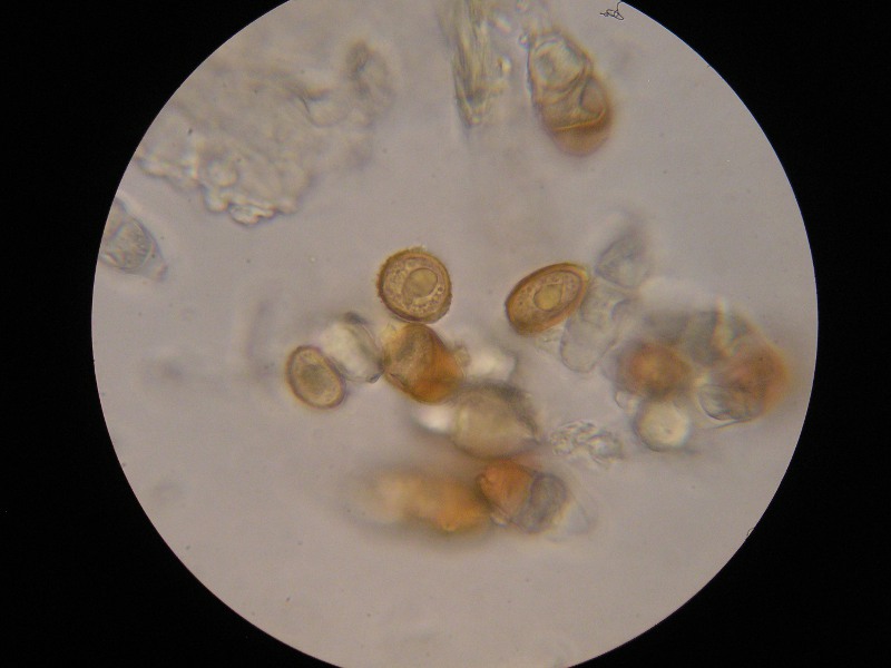 1000er Piller (16).JPG