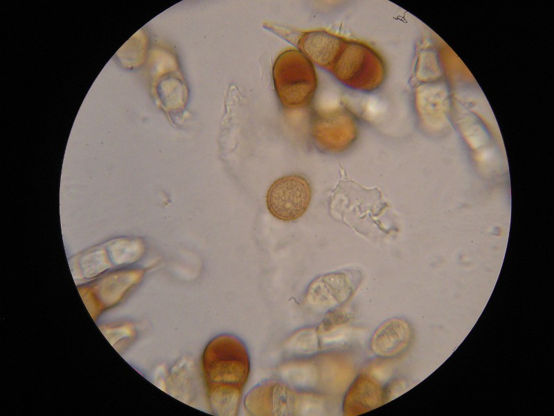 1000er Piller (44).JPG