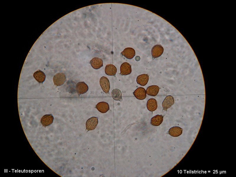 3-Uromyces aecidiiformis-III-1.8.2.9.18.3M2-Lilium candidum.JPG