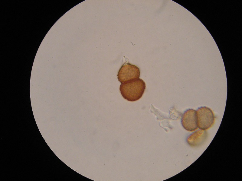 1000er Piller (7).JPG