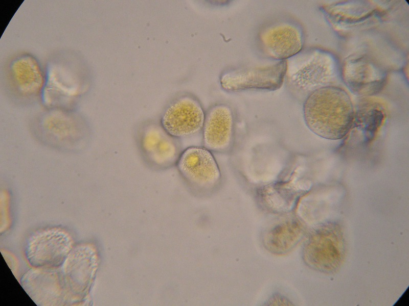 1000er Fließ (15).JPG