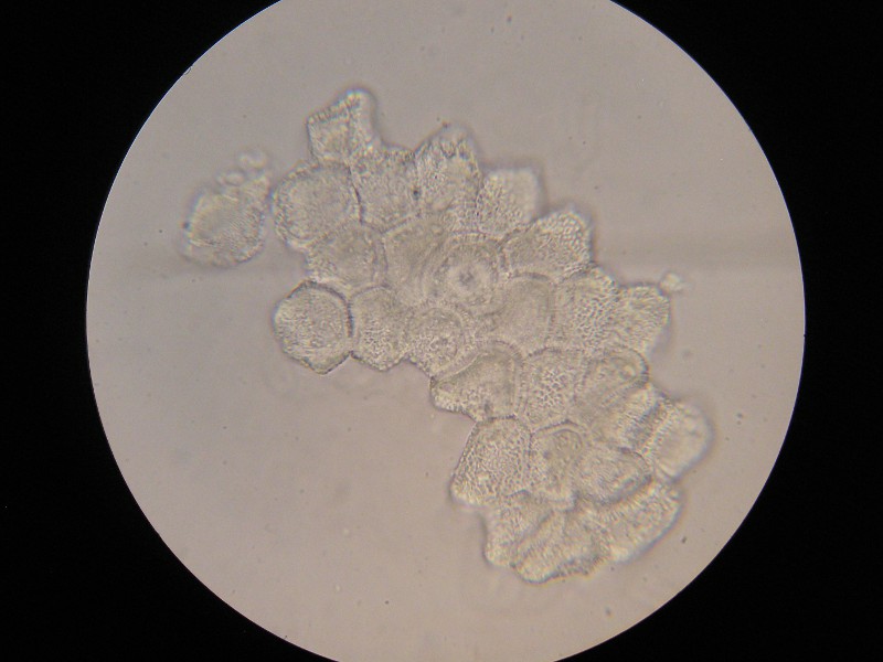 1000er Rofen (38).JPG