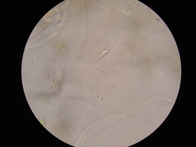 1000er Rofen (13).JPG