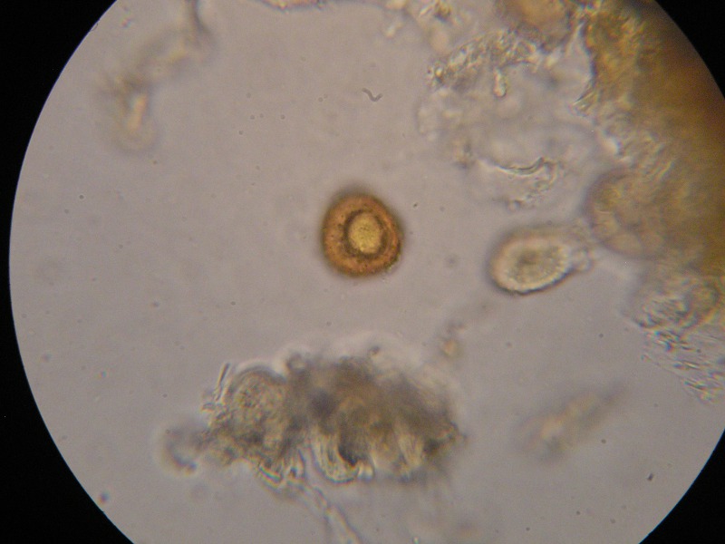 1000er Piller (16).JPG