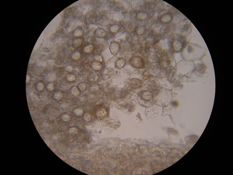 400er Piller (1).JPG